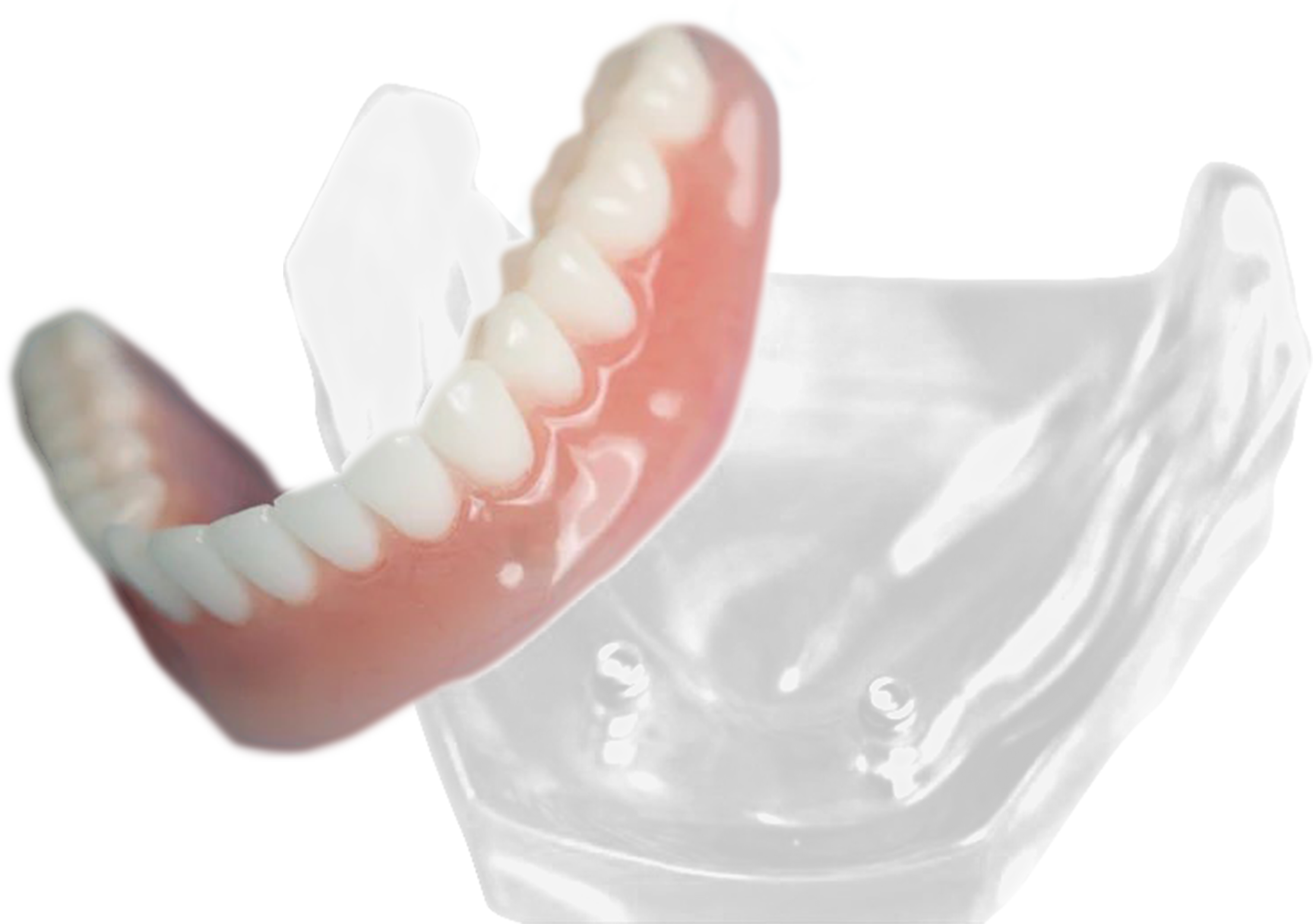 easy snap dental bridge