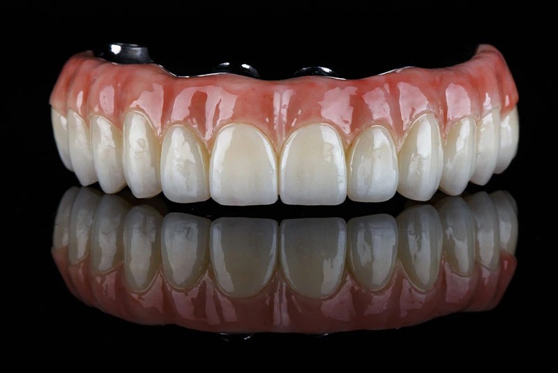 Full Arch With Zirconia Fixed Teeth